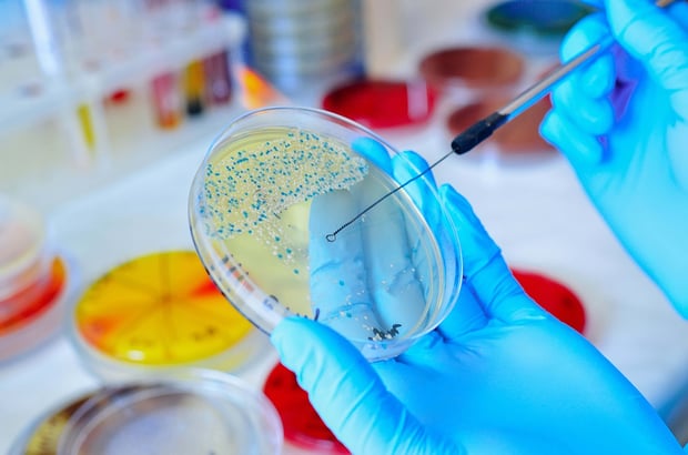Petri dish with mold, fungal cultures, and bacterial samples in a microbiological laboratory.