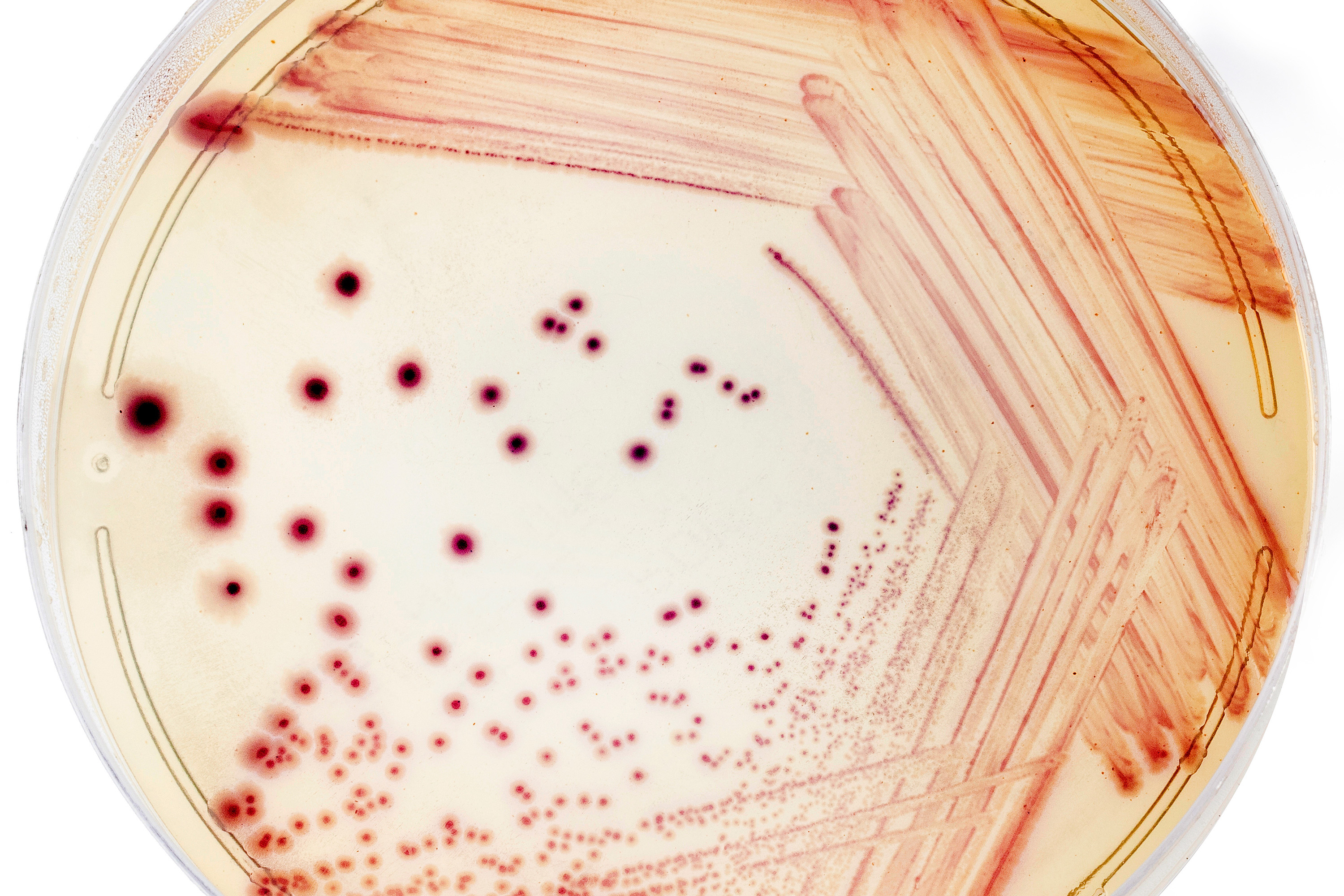 Escherichia coli bacterial cultures on a white background.
