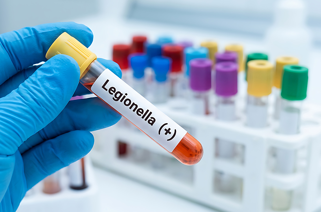 Gloved hand holding a Legionella sample tube in a laboratory test rack.