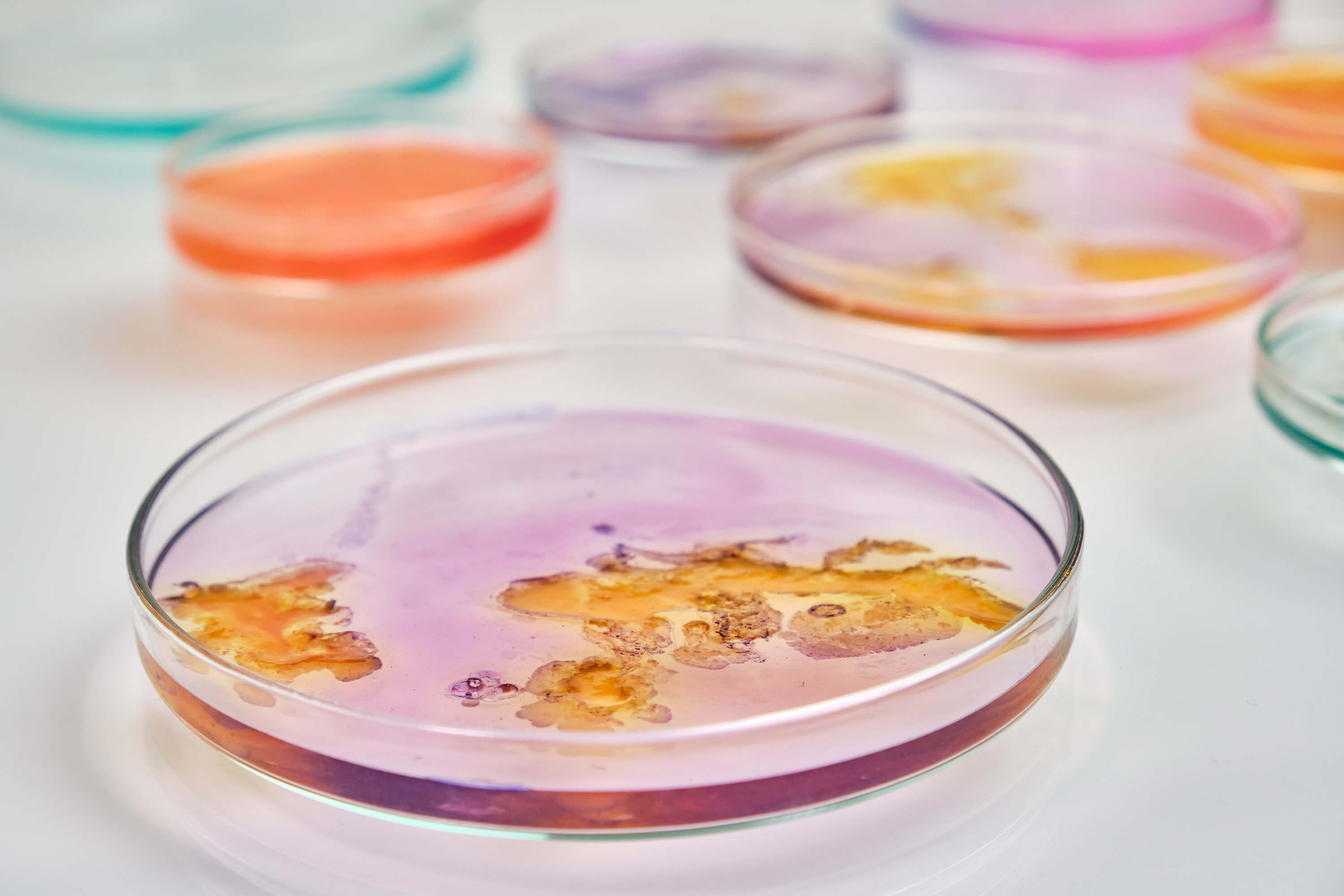 Petri dishes filled with colorful bacterial growth media.