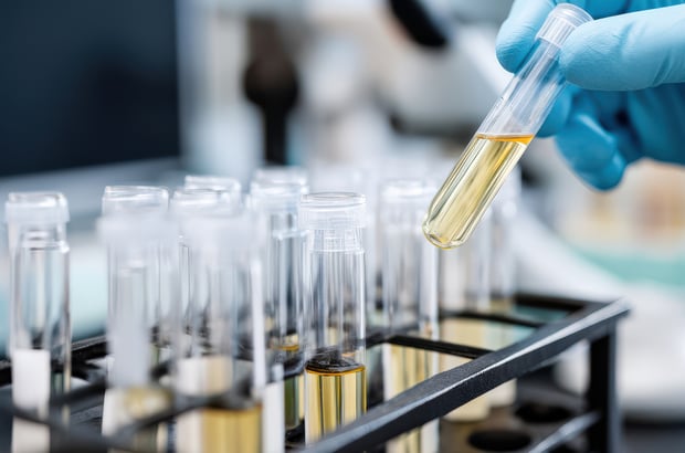 Gloved hand holding a sample tube above a rack of prepared samples in a laboratory.