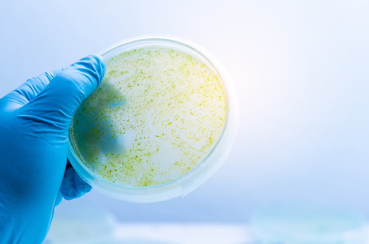 Microbial identification supporting water hygiene investigations and microbiological risk assessment.