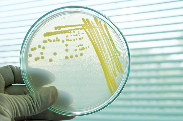 Petri dish with bacterial colonies examined in a laboratory setting.