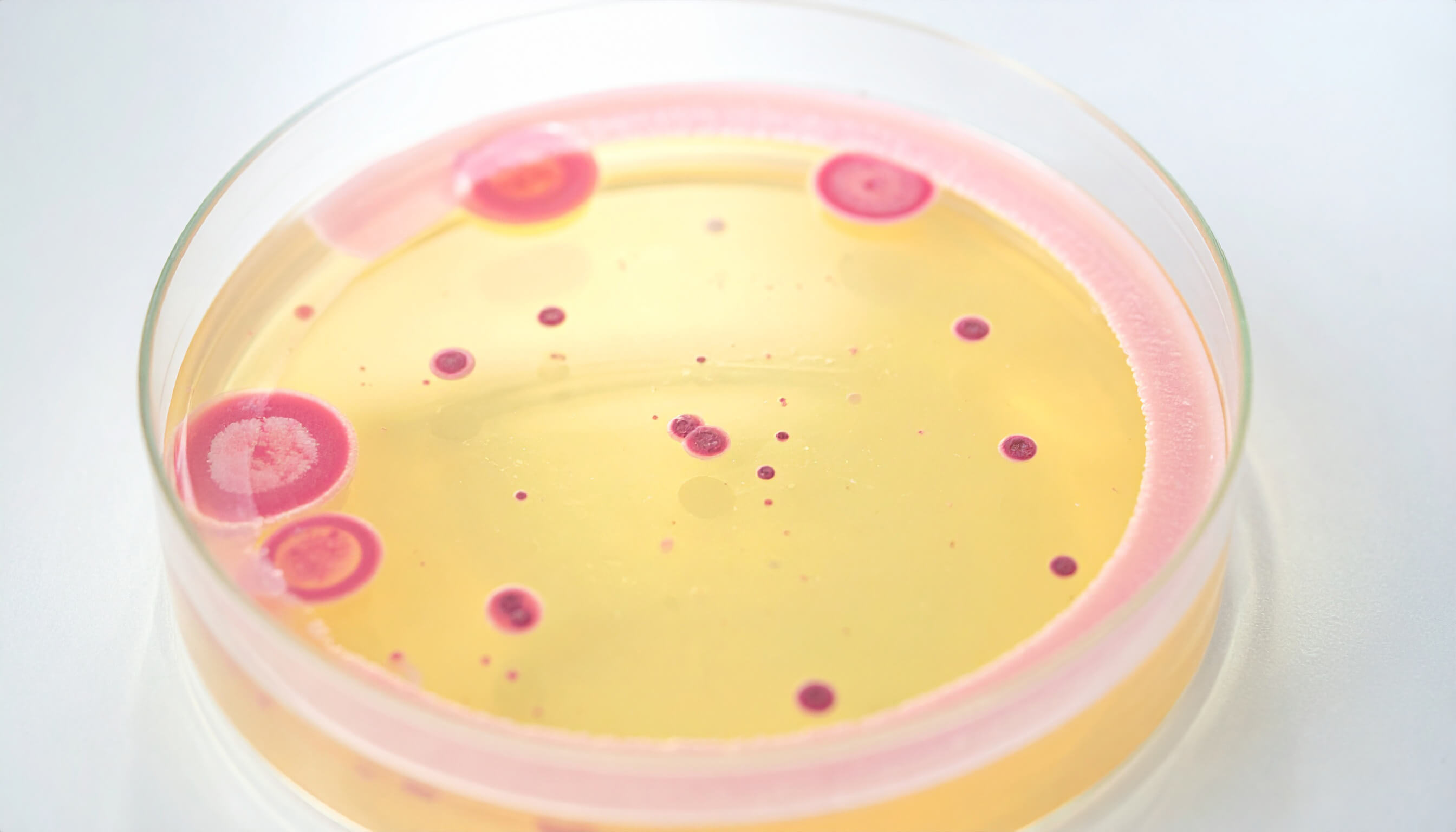 A petri dish shows bacterial colonies growing on a culture medium.
