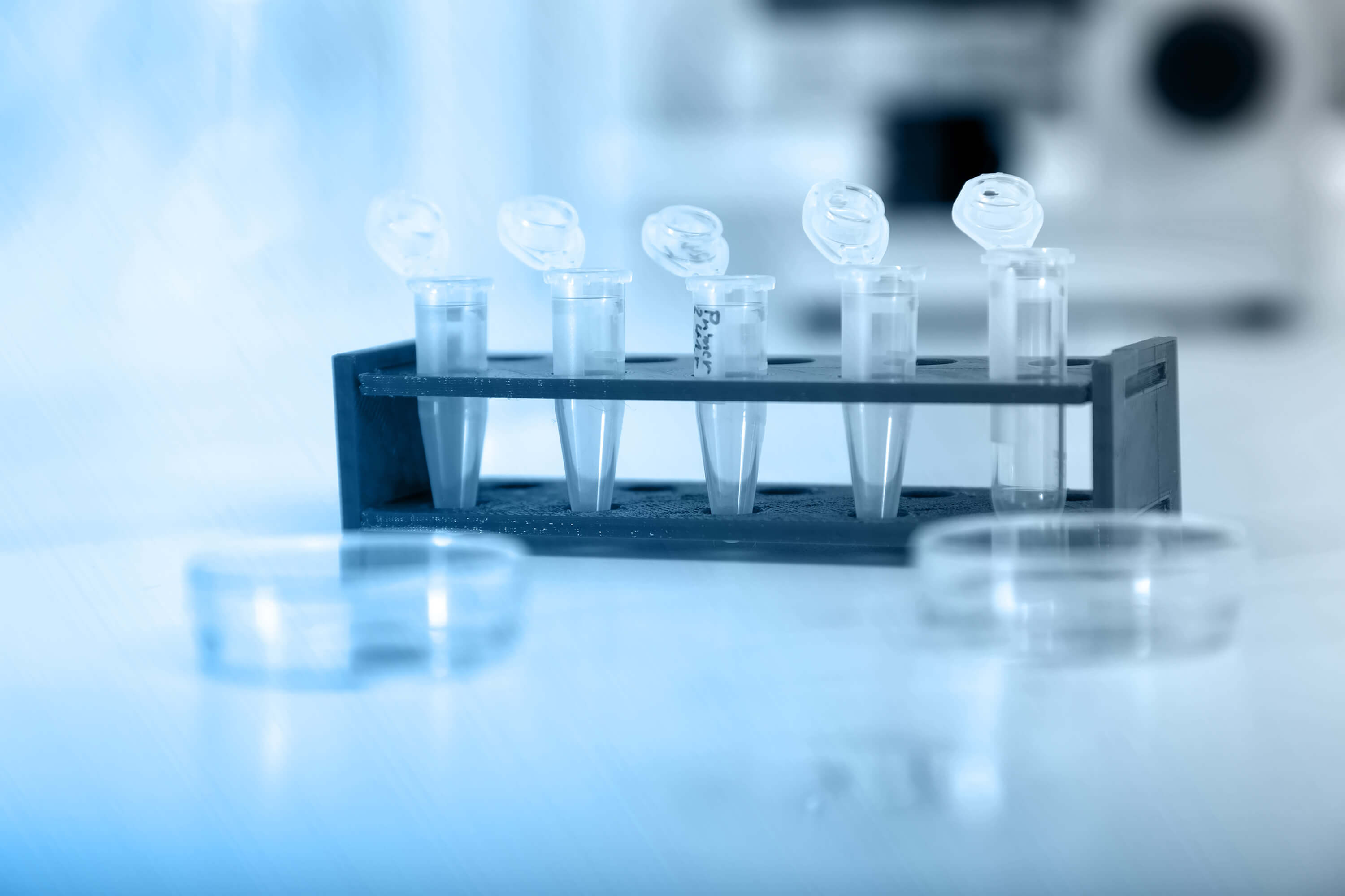Micro tubes with biological samples in laboratory for DNA analysis.